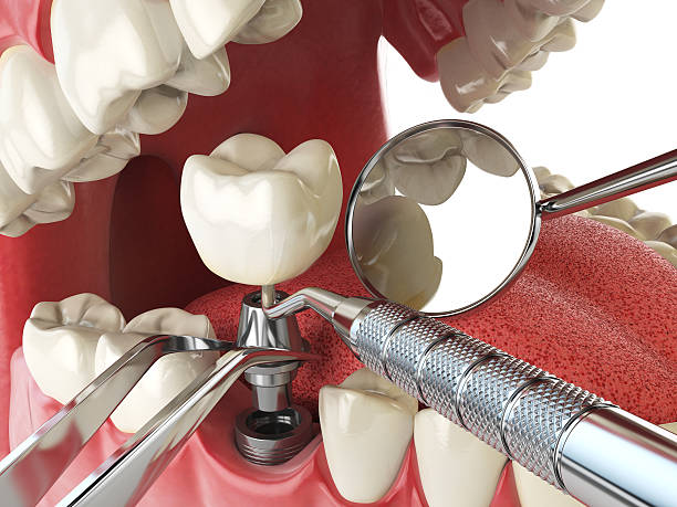 Best Emergency Orthodontic Repairs in Henderson, GA